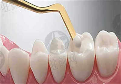 金华婺城口腔医院怎么样?曹玉飞即刻种植技术专业高效,大家都信赖